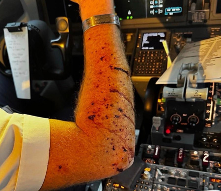 Uçağı Kokpit Camı Kırıldı... Pilot Yaralandı!