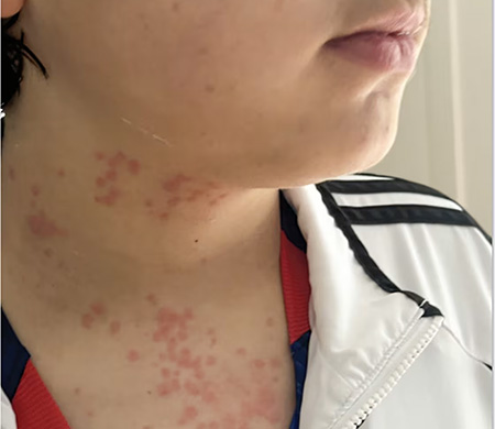 Uçakta tahta kurusu kâbusu!